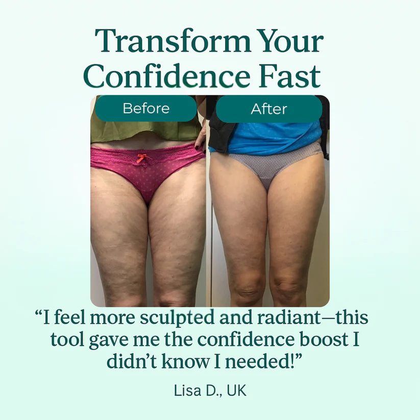 Anti-Cellulite | Firm & Tone Tool
