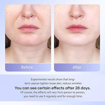 CelluSmooth™ Wrinkle Remover