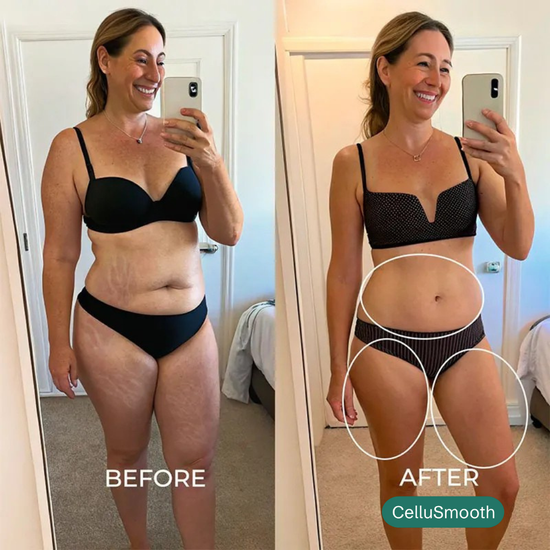 Anti-Cellulite | Firm & Tone Tool