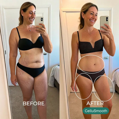 Anti-Cellulite | Firm & Tone Tool